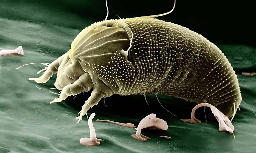 Dust Mite Under a Microscope